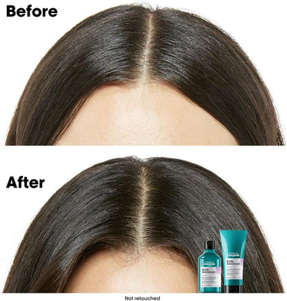 L’Oréal Professionnel | Scalp Advanced Anti-Discomfort Dermo-Regulator Shampoo 300ml