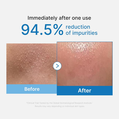 medicube Zero Pore Blackhead Cleansing Oil 205ml