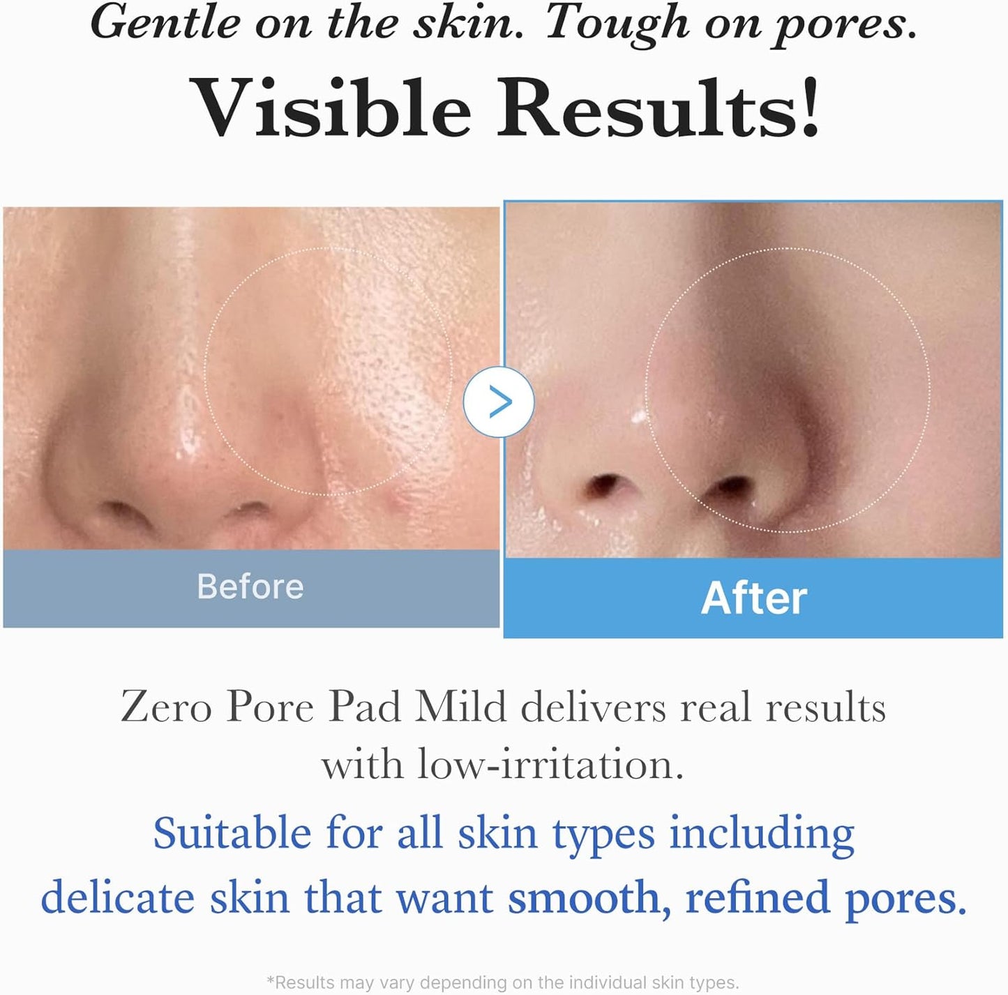 Medicube Zero Pore Pads Mild 2.0 - 155gr