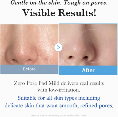 Medicube Zero Pore Pads Mild 2.0 - 155gr