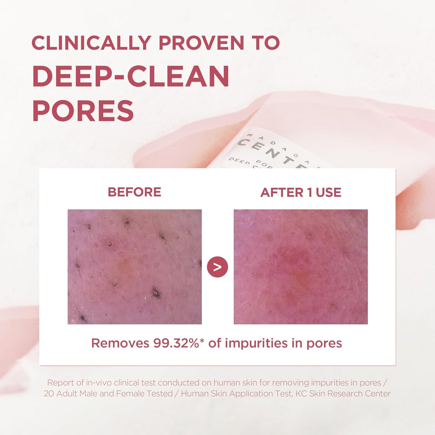 Madagascar Centella Poremizing Deep Cleansing Foam 125ml