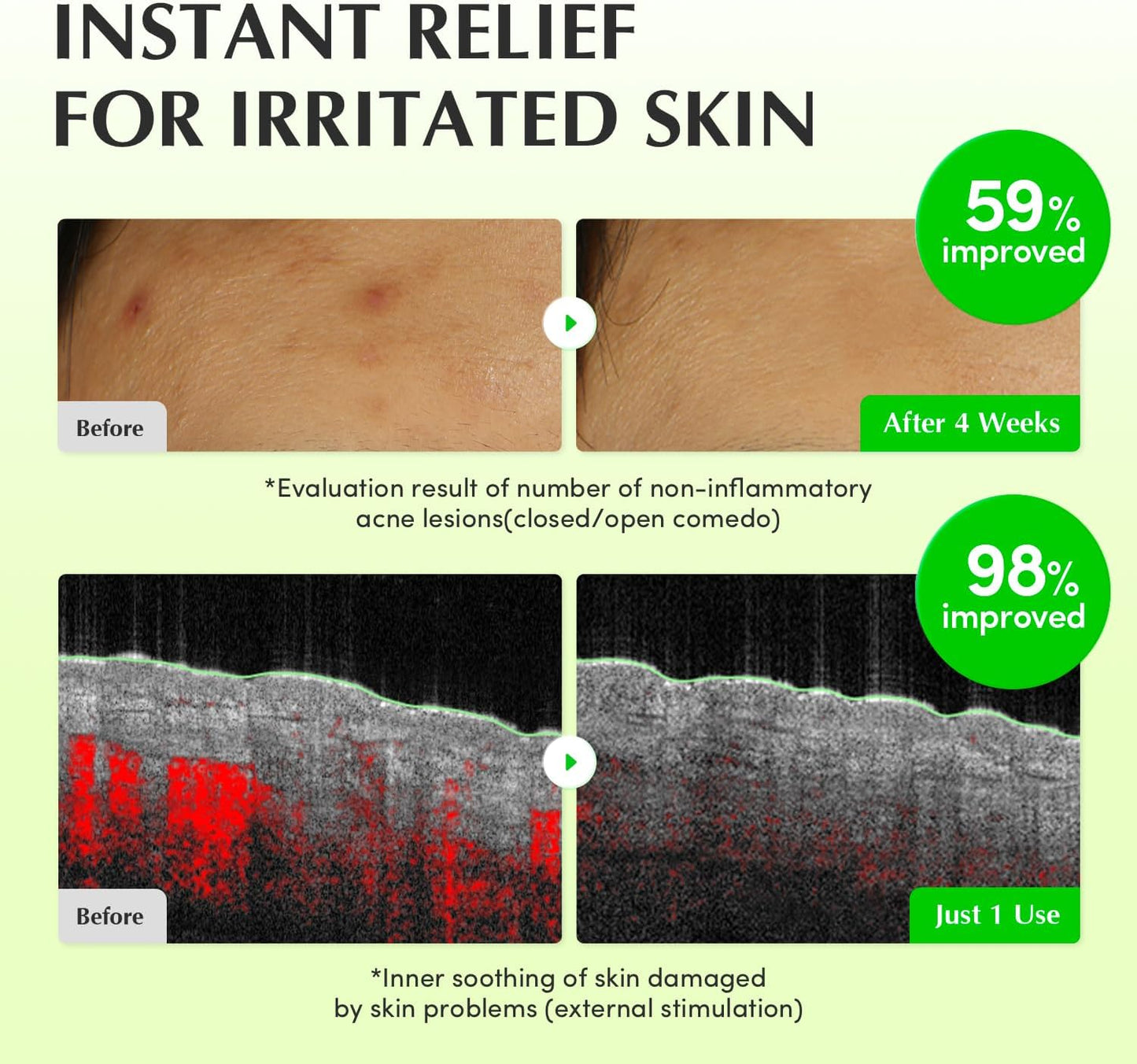 EQQUALBERRY Aloe PDRN Calming Toner 150 ml