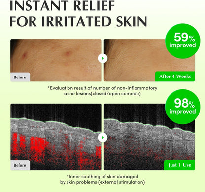 EQQUALBERRY Aloe PDRN Calming Toner 150 ml