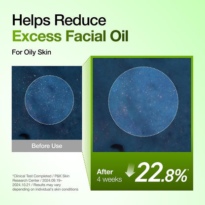 Anua Azelaic Acid 10 Hyaluron Redness Soothing Serum 30ml